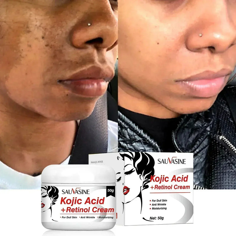 Retinol Cream Dark Spots Remover