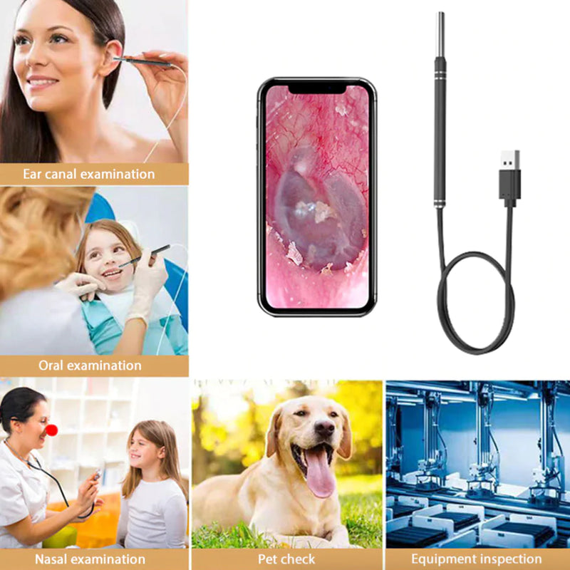 HD LED Ear Endoscope Otoscope Camera Wax Pick Cleaning Tool Cleaner Removal Kit