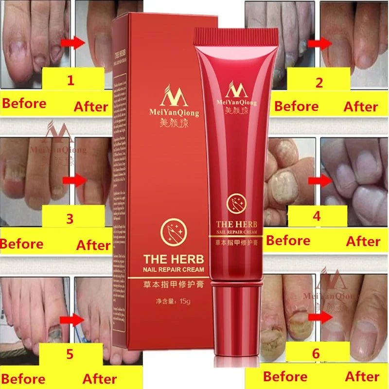 Nail Repair Cream