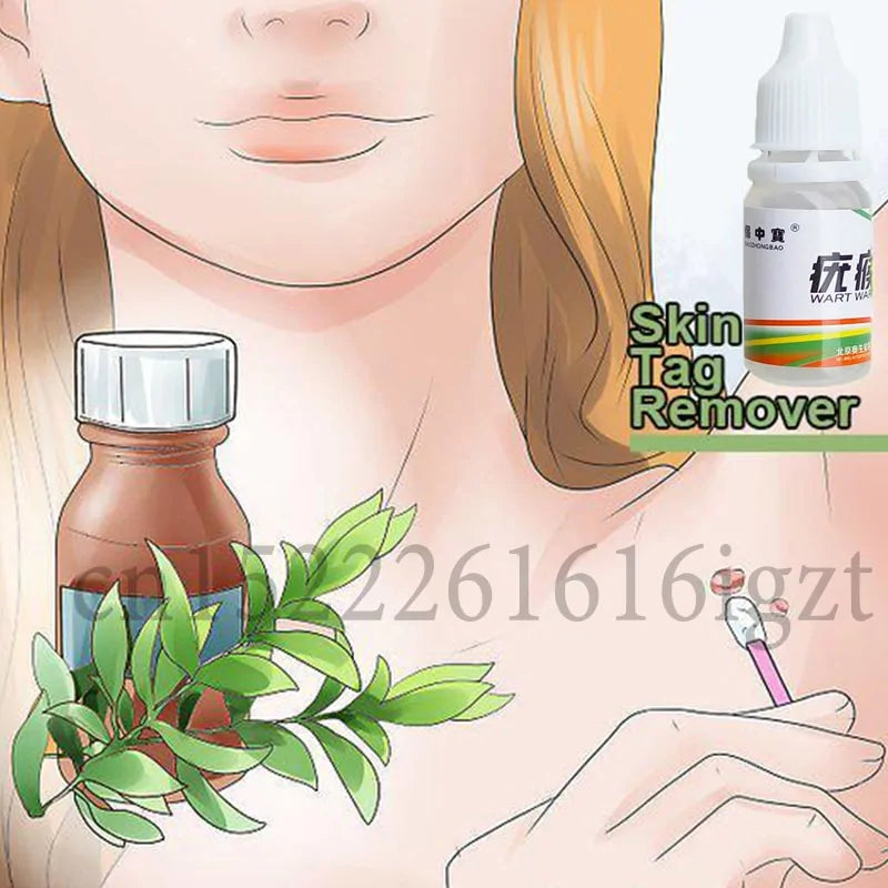 12-Hour Skin Tag Remover