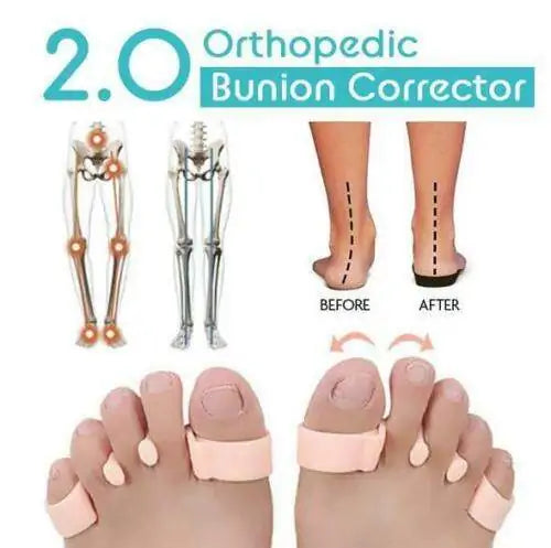 OrthoCorrect? Bunnion Corrector/